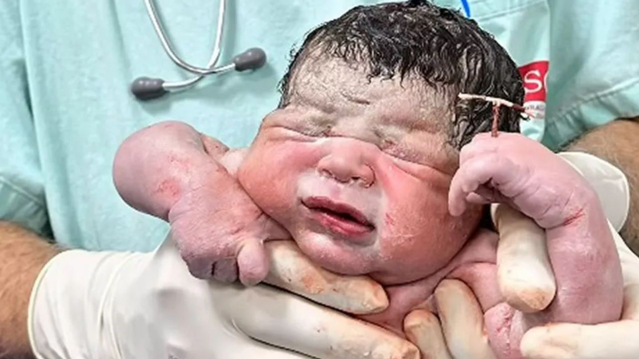 गर्भवती नहीं होना चाहती थी महिला, बच्चा कॉपर-टी लेकर पैदा हो गया