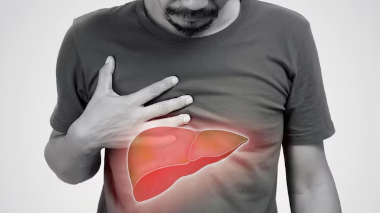 Fatty Liver