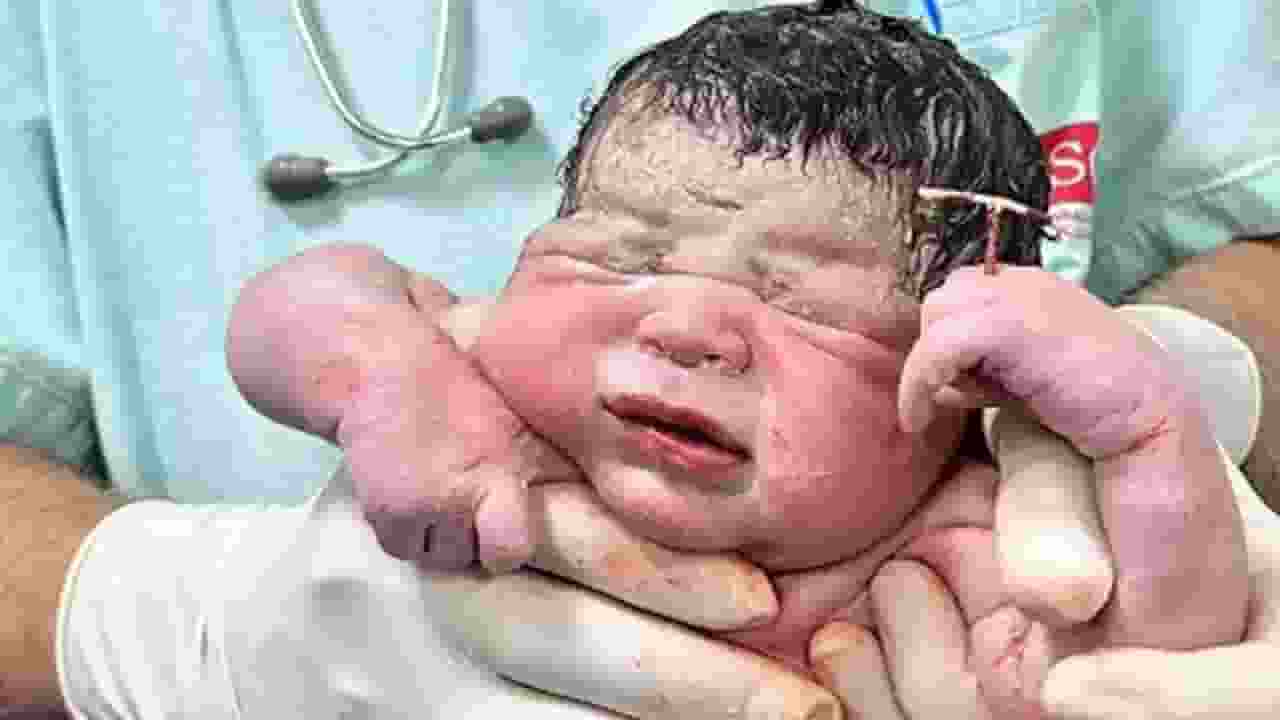 गर्भवती नहीं होना चाहती थी महिला, बच्चा कॉपर-टी लेकर पैदा हो गया