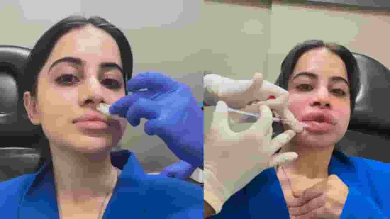 urfi javed lip filler surgery