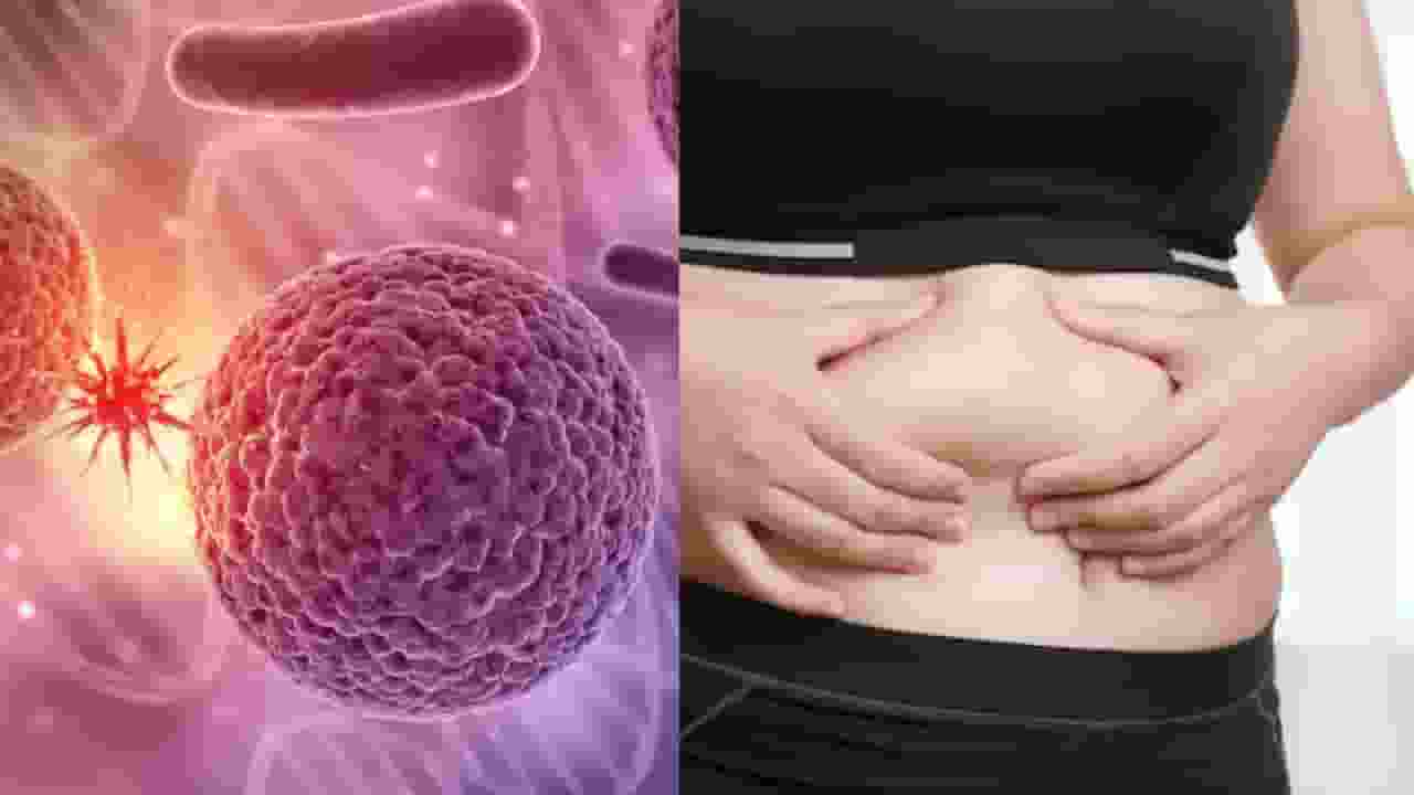 obestity cause cancer