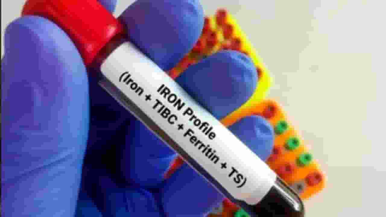  ferritin test