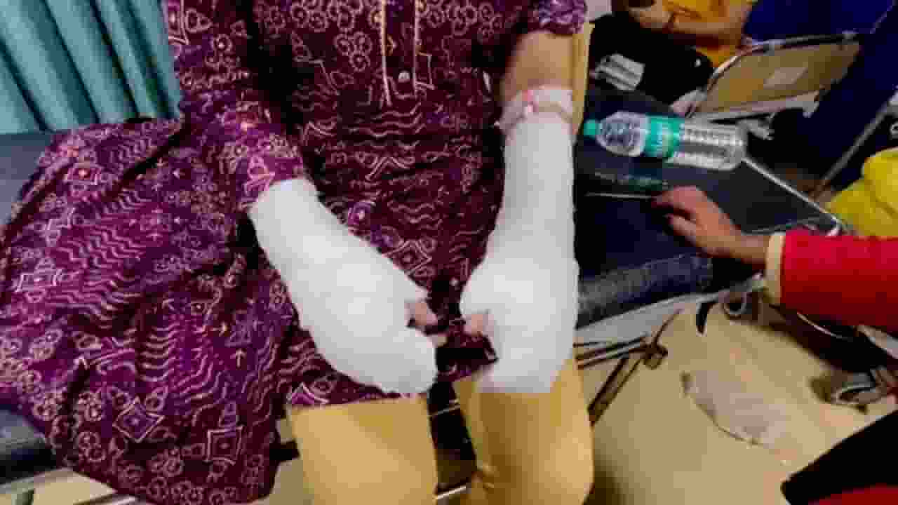 Women with injured hand । Photo Credit: PTI