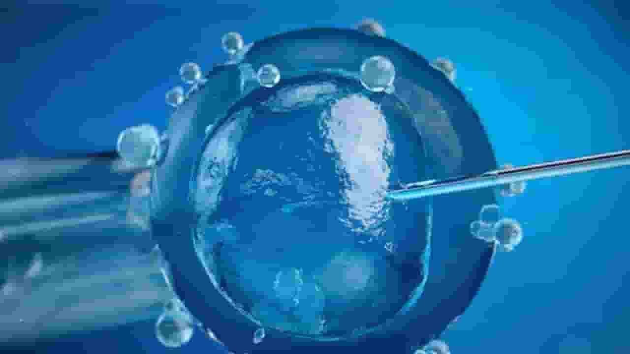IVF की जरूरत कपल को कब पड़ती है, सही उम्र क्या है?  ivf